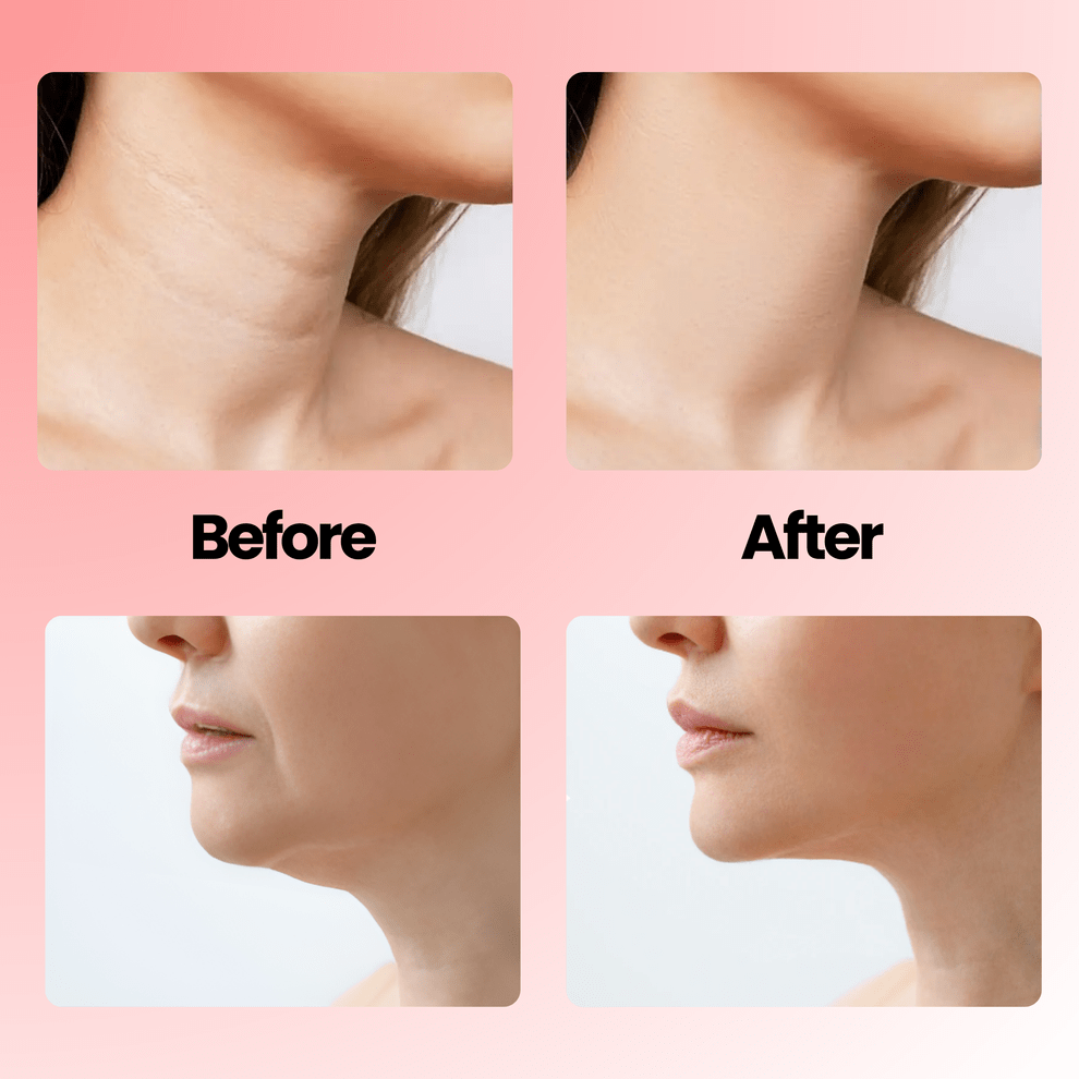 Korose 7 in 1 EMS LED Facial Sculptor