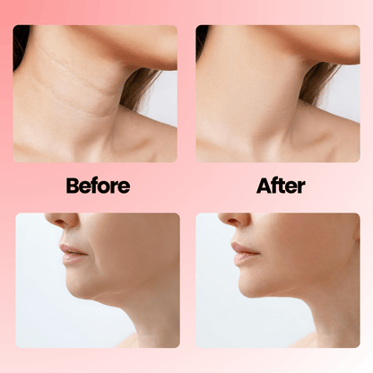 Korose 7 in 1 EMS LED Facial Sculptor